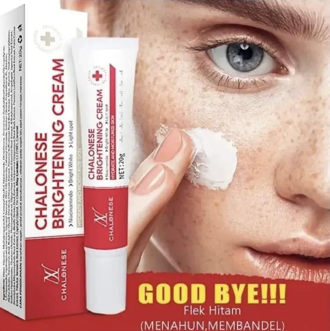 Chalose Brightening Cream 20ml Whitening All Skin Types