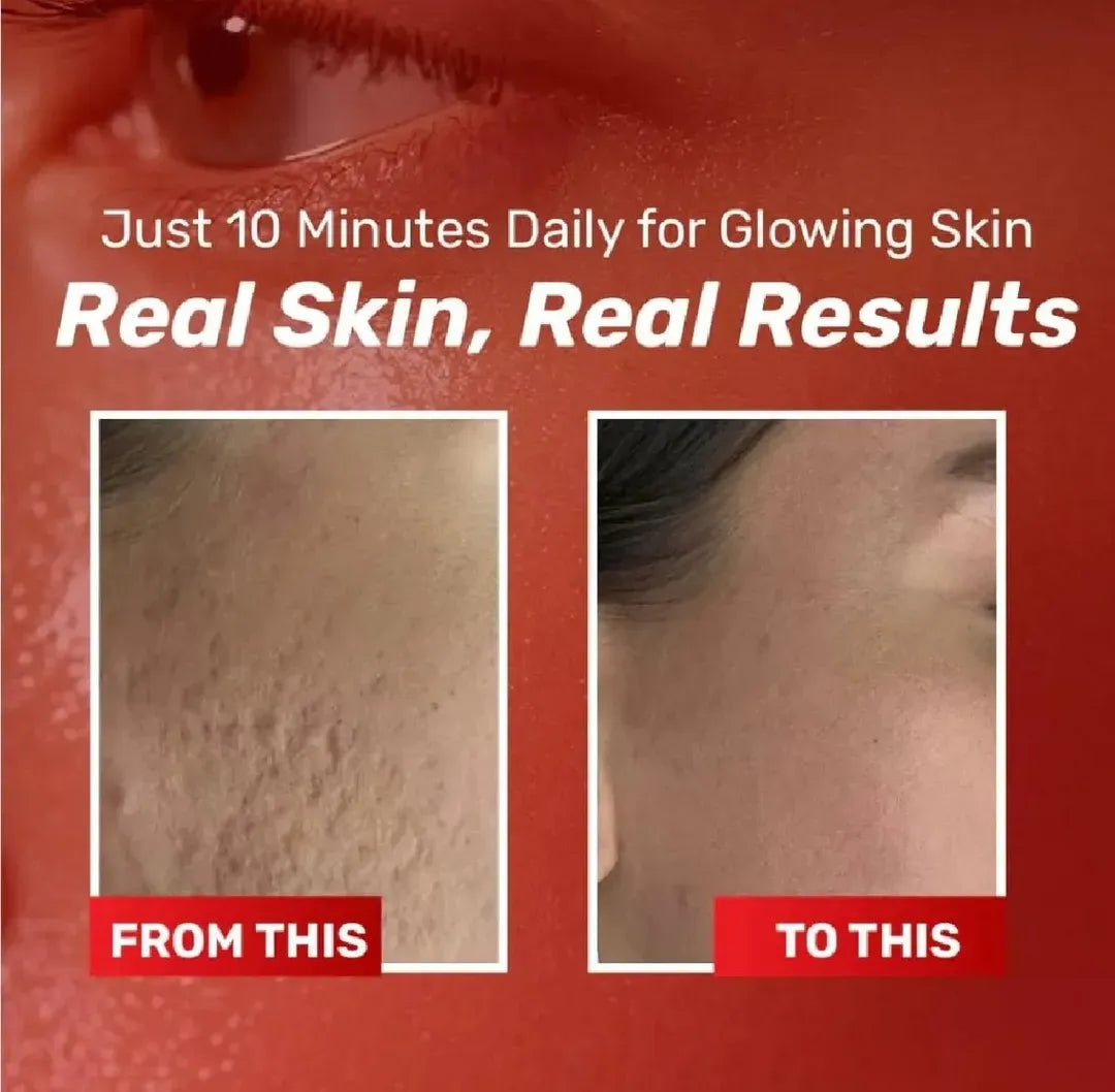 Chalose Brightening Cream 20ml Whitening All Skin Types